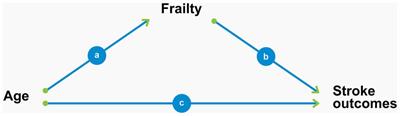 To what extent does frailty mediate the association between age and the outcomes of brain reperfusion following acute ischemic stroke?